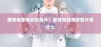 腰部疱疹快好的图片？腰部带状疱疹图片是什么