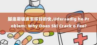 脚底磨破皮怎样好的快,Udersadig he Problem: Why Does Ski Crack o Fee?